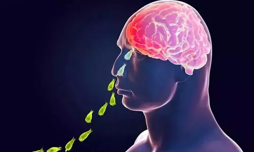 amoebic encephalitis