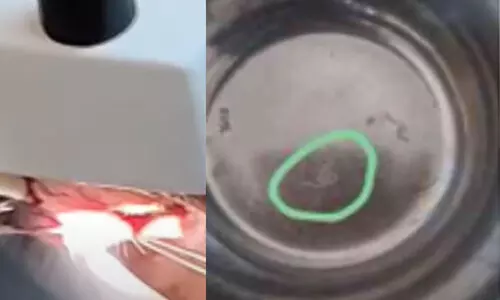 കണ്ണിൽ തടിപ്പ്, അസ്വാഭാവികതയില്ലെന്ന് പറഞ്ഞ് സ്വകാര്യ ആശുപത്രിയിൽ നിന്ന് മടക്കി; താലൂക്കാശുപത്രിലെത്തിയ വയോധികന്റെ കണ്ണിൽ നിന്ന് വിരയെ പുറത്തെടുത്തു