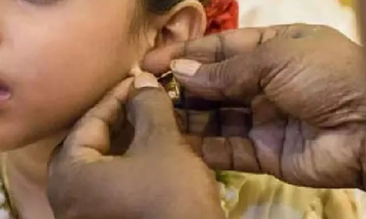 സ്വർണ വ്യാപാരികൾ ആയിരം കുരുന്നുകൾക്ക്​ സൗജന്യമായി കാതുകുത്തി കമ്മലിടുന്നു