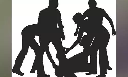 Representation Image