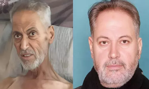 ഗസ്സയിലെ കൊടുംപട്ടിണി: പ്രമുഖ ഫലസ്തീനി കവി ഉമർ ഹർബ് വിടവാങ്ങി, 120 കിലോഗ്രാം ഭാരം മരിക്കുമ്പോൾ 40ൽ താഴെയായി കുറഞ്ഞു ഗസ്സയിലെ കൊടുംപട്ടിണി: പ്രമുഖ ഫലസ്തീനി കവി ഉമർ ഹർബ് വിടവാങ്ങി, 120 കിലോഗ്രാം ഭാരം മരിക്കുമ്പോൾ 40ൽ താഴെയായി കുറഞ്ഞു