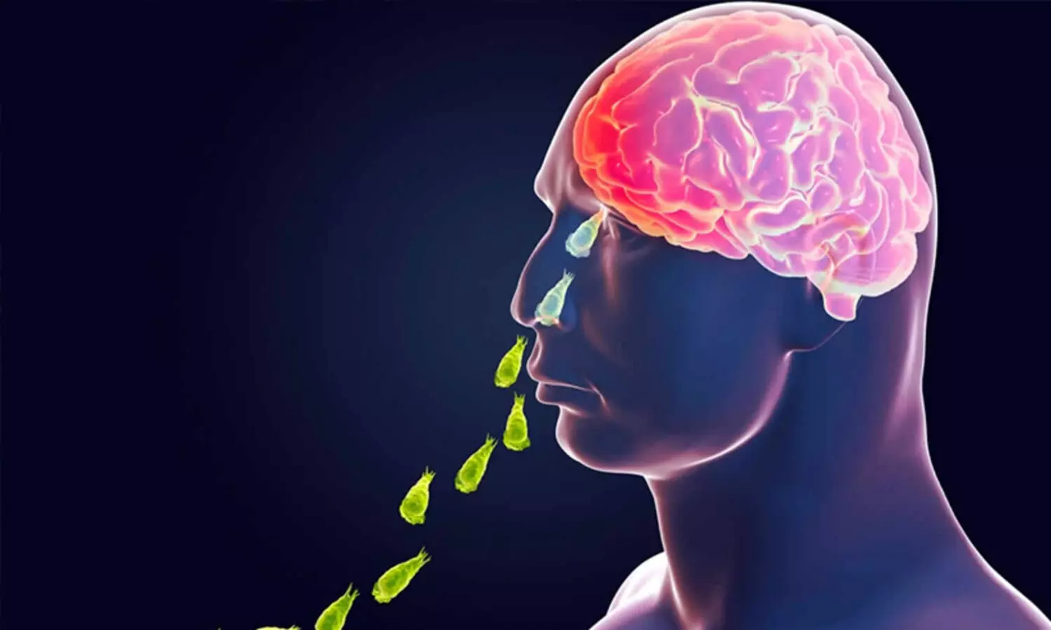 amebic meningoencephalitis