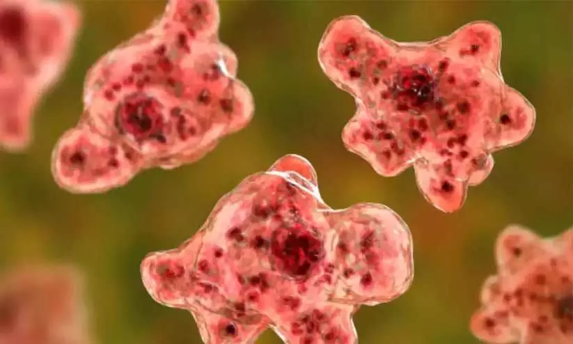 Amebic encephalitis Amebic encephalitis