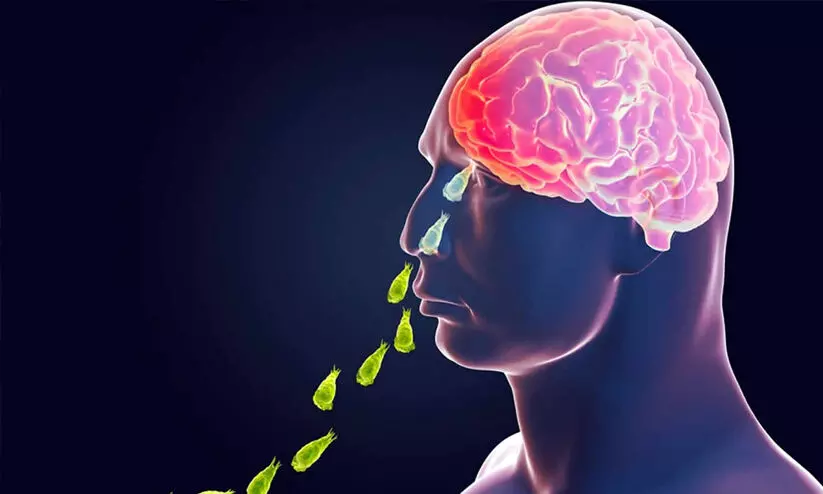 amebic meningoencephalitis amebic meningoencephalitis