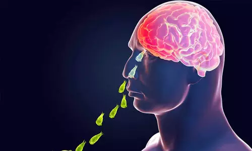 amebic meningoencephalitis