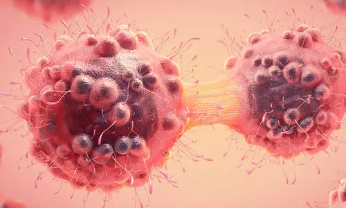 പുതിയ വാക്സിൻ അർബുദം പ്ര​തി​രോ​ധി​ക്കാ​നു​ള്ള​ത​ല്ല,  ആവർത്തിക്കുന്നത് തടയാൻ -ഐ.എം.എ