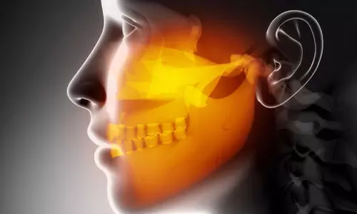 Representation Image