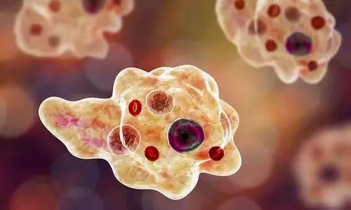 Amoebic Meningitis Amoebic Meningitis