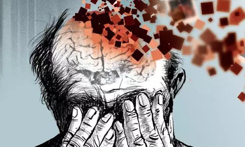 മിതമായ അളവിലുള്ള മദ്യം പോലും തലച്ചോറിനെ ചുരുക്കും; ദീർഘകാല മദ്യപാനം ഡിമെൻഷ്യക്ക് കാരണമാകും