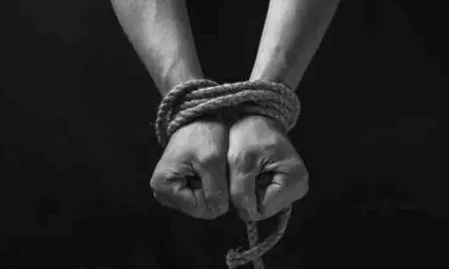 representative image representative image