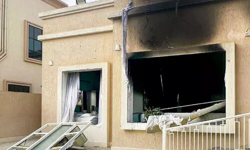 ഖോ​ർ​ഫു​ക്കാ​നി​ൽ വീ​ടി​ന് തീ​പി​ടി​ച്ച് സ്വ​ദേ​ശി​ക്ക്​ പ​രി​ക്ക്​