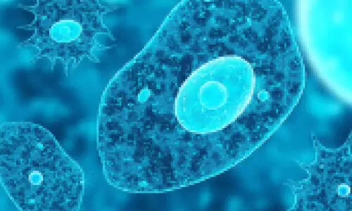 Representation Image