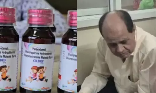 representative image representative image