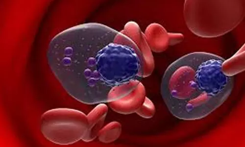 സോഷ്യൽ മീഡിയ വ്യാപകമായി ചർച്ച ചെയ്യുന്ന മൾട്ടിപ്പിൾ മൈലോമ ചികിത്സയില്ലാ രോഗമോ?