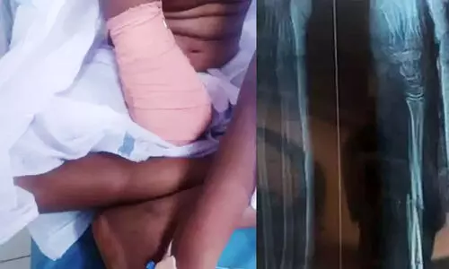 Medical Negligence in Palakkad District Hospital