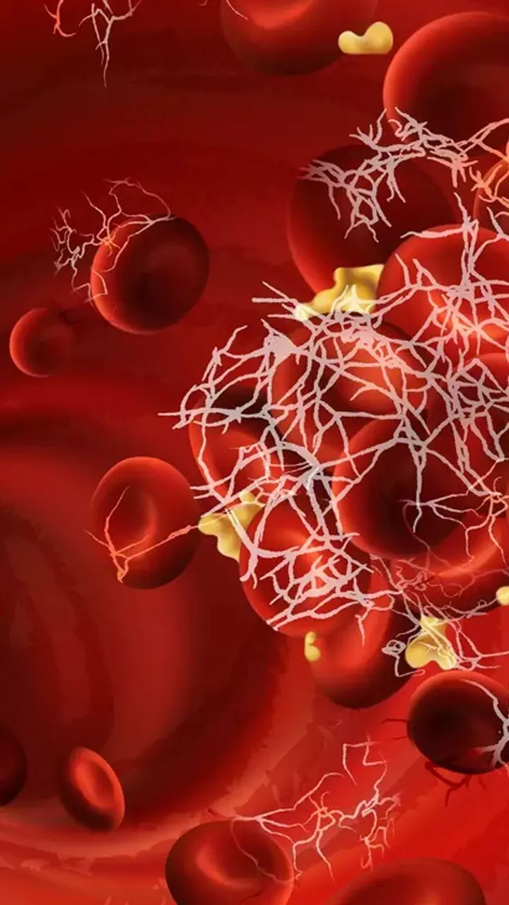 മൾട്ടിപ്പിൾ മൈലോമ ചികിത്സയില്ലാ രോഗമോ? ലക്ഷണങ്ങൾ