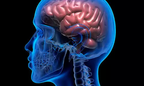 Fat Can Secretly Contribute To Alzheimers Disease: Study