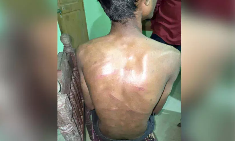 വിദ്യാർഥിയെ വീട്ടിൽനിന്ന് വിളിച്ചിറക്കി മർദനം; നാലുപേർ കസ്റ്റഡിയിൽ വിദ്യാർഥിയെ വീട്ടിൽനിന്ന് വിളിച്ചിറക്കി മർദനം; നാലുപേർ കസ്റ്റഡിയിൽ