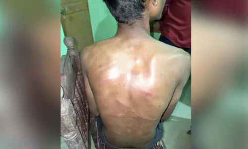 വിദ്യാർഥിയെ വീട്ടിൽനിന്ന് വിളിച്ചിറക്കി മർദനം; നാലുപേർ കസ്റ്റഡിയിൽ