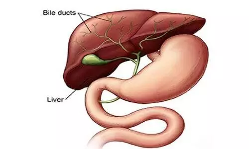 Bile duct cancer