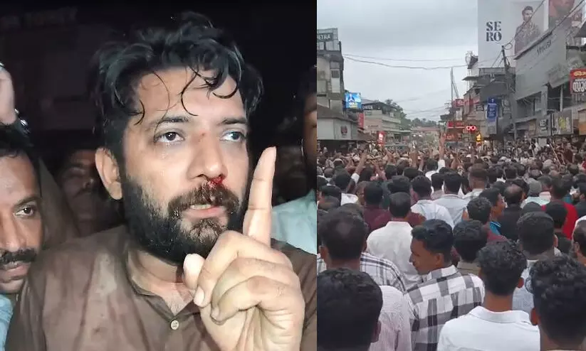 കോഴിക്കോട് പേരാമ്പ്രയിൽ യു.ഡി.എഫ് - എൽ.ഡി.എഫ് സംഘർഷം, ലാത്തിച്ചാർജിൽ ഷാഫി പറമ്പിലിന് പരിക്ക് കോഴിക്കോട് പേരാമ്പ്രയിൽ യു.ഡി.എഫ് - എൽ.ഡി.എഫ് സംഘർഷം, ലാത്തിച്ചാർജിൽ ഷാഫി പറമ്പിലിന് പരിക്ക്