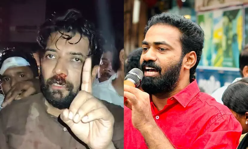 ‘ഷാഫിയുടെ ഷോയാണ് നമ്മൾ ഇന്നലെ അവിടെ കണ്ടത്’ -ഡി.വൈ.എഫ്.ഐ നേതാവ് വി.കെ. സനോജ്; ‘വഴിയിൽ കൂടി നടക്കുന്ന ഷാഫിക്കാണോ മർദനമേറ്റത്?’ ‘ഷാഫിയുടെ ഷോയാണ് നമ്മൾ ഇന്നലെ അവിടെ കണ്ടത്’ -ഡി.വൈ.എഫ്.ഐ നേതാവ് വി.കെ. സനോജ്; ‘വഴിയിൽ കൂടി നടക്കുന്ന ഷാഫിക്കാണോ മർദനമേറ്റത്?’