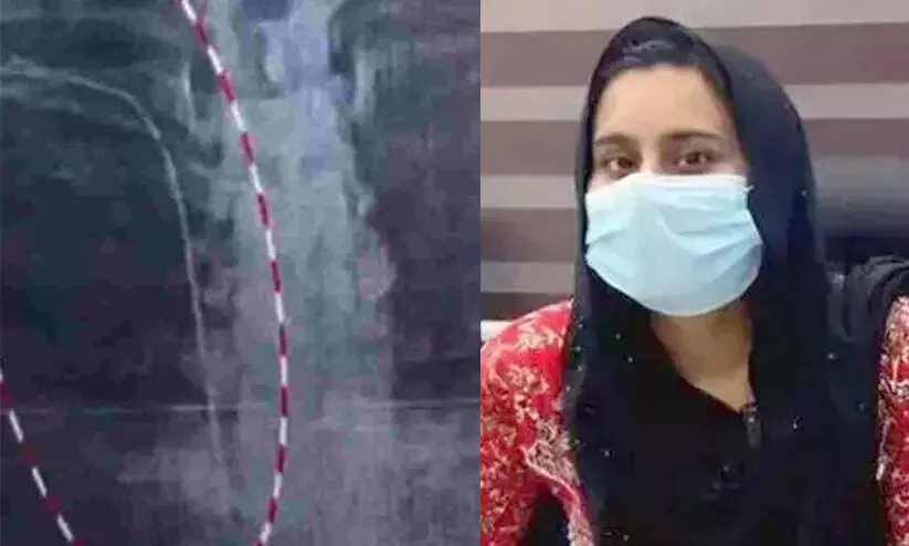 ശസ്ത്രക്രിയ പിഴവ്: നെഞ്ചില്‍ കുടുങ്ങിയ ഗൈഡ് വയര്‍ നീക്കാന്‍ കഴിയില്ലെന്ന് അറിയിച്ചതായി സുമയ്യ