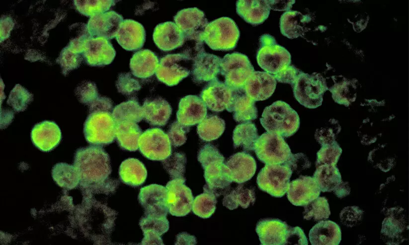 അമീബിക് മസ്തിഷ്ക ജ്വരം: കടയ്ക്കലിൽ ഒരാൾക്ക്കൂടി രോഗം സ്ഥിരീകരിച്ചു അമീബിക് മസ്തിഷ്ക ജ്വരം: കടയ്ക്കലിൽ ഒരാൾക്ക്കൂടി രോഗം സ്ഥിരീകരിച്ചു