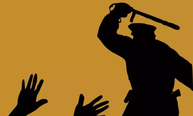 പൊലീസ് മർദനം: വിവരാവകാശ കമീഷനും തുണയായില്ല; ഉദ്യോഗസ്ഥന് താക്കീത് മാത്രം