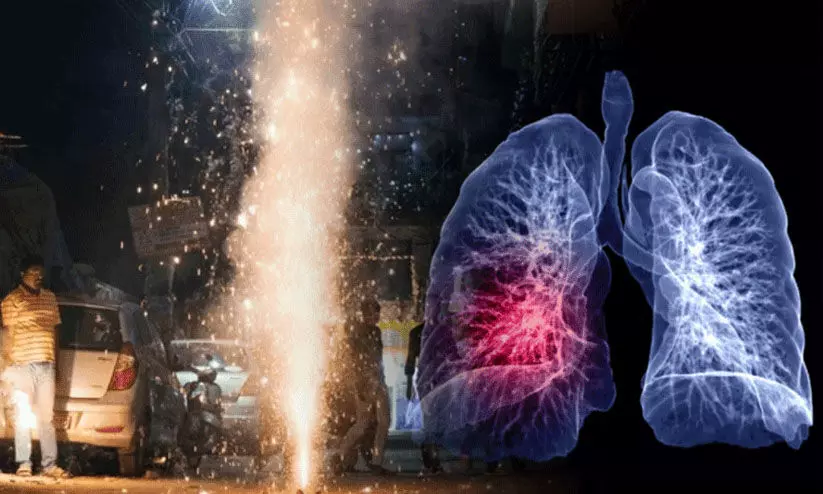 ‘പടക്കം ആകാശത്തെ പ്രകാശിപ്പിക്കുക മാത്രമല്ല, ശ്വാസകോശത്തെ വീർപ്പിക്കുകയും ചെയ്യും’:  ദീപാവലി വേളയിൽ ജാഗ്രതാ മുന്നറിയിപ്പുമായി ആരോഗ്യ വിദഗ്ധർ
