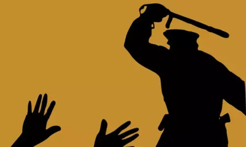 പൊലീസ് മർദനം: വിവരാവകാശ കമീഷനും തുണയായില്ല; ഉദ്യോഗസ്ഥന് താക്കീത് മാത്രം പൊലീസ് മർദനം: വിവരാവകാശ കമീഷനും തുണയായില്ല; ഉദ്യോഗസ്ഥന് താക്കീത് മാത്രം