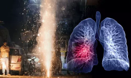 ‘പടക്കം ആകാശത്തെ പ്രകാശിപ്പിക്കുക മാത്രമല്ല, ശ്വാസകോശത്തെ വീർപ്പിക്കുകയും ചെയ്യും’: ദീപാവലി വേളയിൽ ജാഗ്രതാ മുന്നറിയിപ്പുമായി ആരോഗ്യ വിദഗ്ധർ ‘പടക്കം ആകാശത്തെ പ്രകാശിപ്പിക്കുക മാത്രമല്ല, ശ്വാസകോശത്തെ വീർപ്പിക്കുകയും ചെയ്യും’: ദീപാവലി വേളയിൽ ജാഗ്രതാ മുന്നറിയിപ്പുമായി ആരോഗ്യ വിദഗ്ധർ