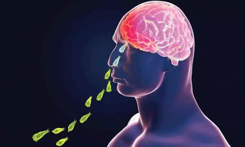 അമീബിക് മസ്തിഷ്ക ജ്വരം