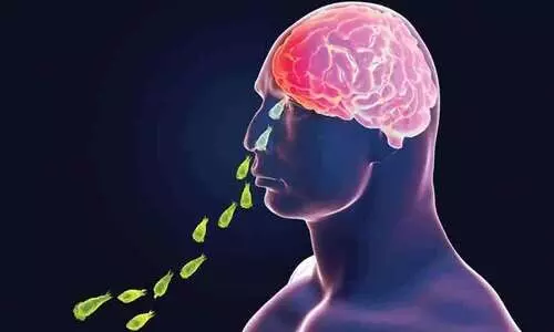 അമീബിക് മസ്തിഷ്ക ജ്വരം