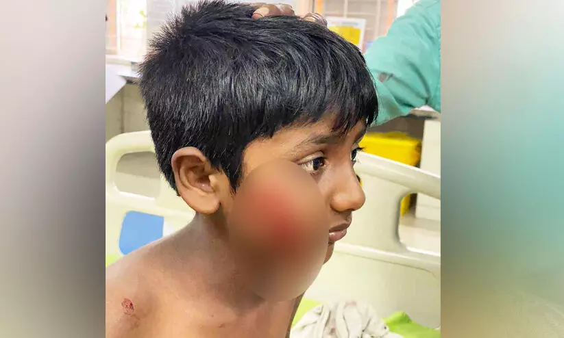 dhyan -stray dog attack