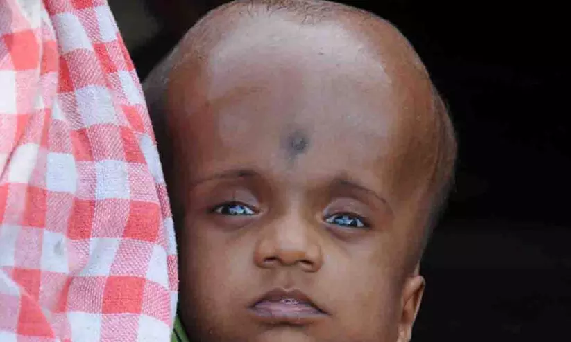 എൻഡോസൾഫാൻ: ധനസഹായത്തിന് ഇനി കലക്ടർ കനിയണം