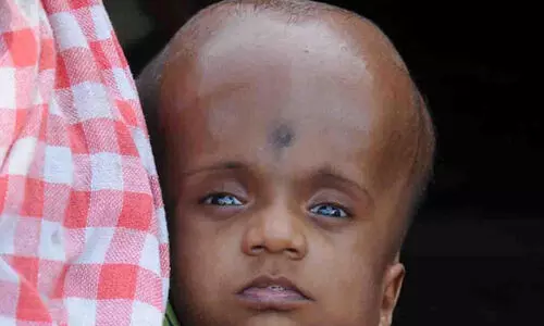 എൻഡോസൾഫാൻ: ധനസഹായത്തിന് ഇനി കലക്ടർ കനിയണം