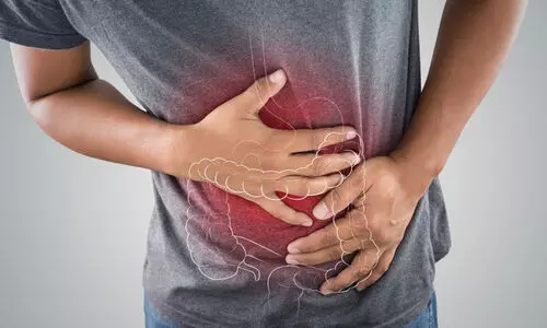 Reprasentative Image