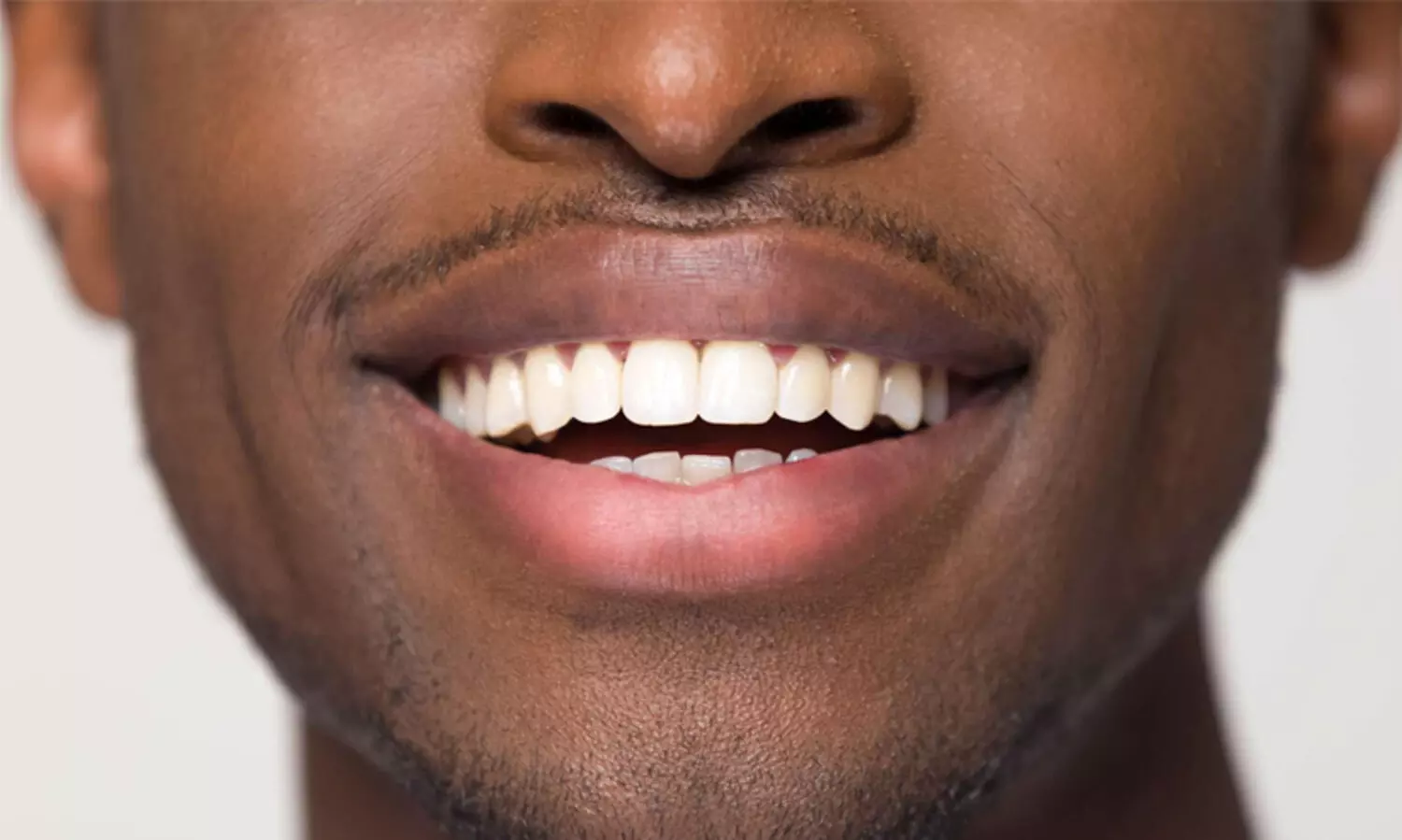 ആരാണ് ഒരു മേക്ക് ഓവർ ആഗ്രഹിക്കാത്തത് ? മുഖ സൗന്ദര്യം വർധിപ്പിക്കുന്നതിൽ ദന്ത ചികിത്സയുടെ പങ്ക്