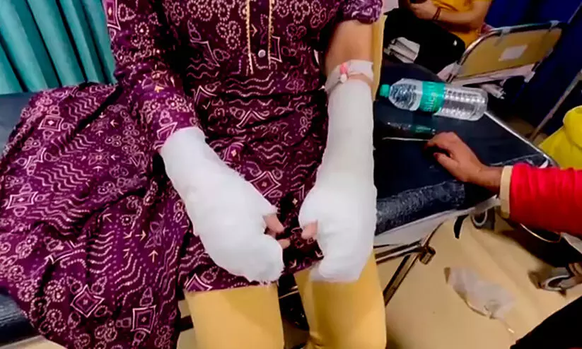 DU Student acid attack