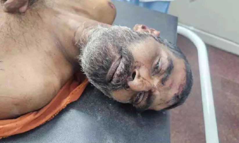 ആലപ്പുഴ സ്വദേശിയെ കൊടുങ്ങല്ലൂരിൽ ഗുരുതര പരിക്കോടെ കണ്ടെത്തി ആലപ്പുഴ സ്വദേശിയെ കൊടുങ്ങല്ലൂരിൽ ഗുരുതര പരിക്കോടെ കണ്ടെത്തി