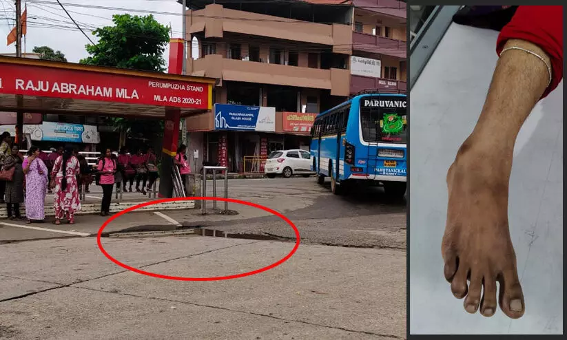 പനിക്ക് ചികിത്സ തേടിയെത്തിയ വീട്ടമ്മ ബസിൽനിന്ന് ഇറങ്ങിയത് പടുകുഴിയിലേക്ക്; കാലിന് പരിക്കുമായി ആശുപത്രിയിൽ പനിക്ക് ചികിത്സ തേടിയെത്തിയ വീട്ടമ്മ ബസിൽനിന്ന് ഇറങ്ങിയത് പടുകുഴിയിലേക്ക്; കാലിന് പരിക്കുമായി ആശുപത്രിയിൽ