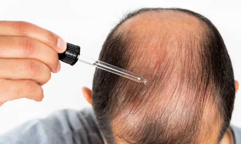 ഹെയർ സിറം കൊഴിഞ്ഞു പോയ മുടി ഇരുപത് ദിവസം കൊണ്ട് വളരാൻ സഹായിക്കുമോ?