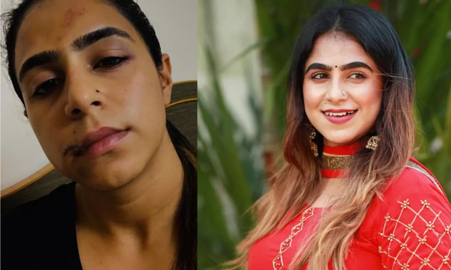 മേൽ ചുണ്ട് മുറിഞ്ഞു, വയറ്റില്‍ ചവിട്ടി, തല നിലത്ത് അടിച്ചു; മുൻ പങ്കാളിയിൽനിന്ന് നേരിട്ട ക്രൂരത വെളിപ്പെടുത്തി നടി ജസീല പർവീൺ