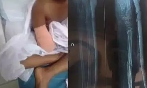 മുഖ്യമന്ത്രിയുടെ ദുരിതാശ്വാസ നിധിയിൽനിന്ന്   അനുവദിച്ചത് രണ്ട് ലക്ഷം മാത്രം; തുക അപര്യാപ്തമെന്ന് ചികിത്സാപിഴവിനെതുടർന്ന് കൈമുറിച്ചുമാറ്റപ്പെട്ട പെൺകുട്ടിയുടെ പിതാവ്