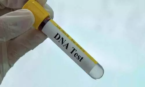 മാ​താ​പി​താ​ക്ക​ളെ അ​റി​യാ​ത്ത കു​ട്ടി​ക​ൾ​ക്ക്; ഡി.​എ​ൻ.​എ പ​രി​ശോ​ധ​ന നി​ർ​ബ​ന്ധ​മാ​ക്കാ​ൻ എം.​പി​മാ​രു​ടെ ശി​പാ​ർ​ശ