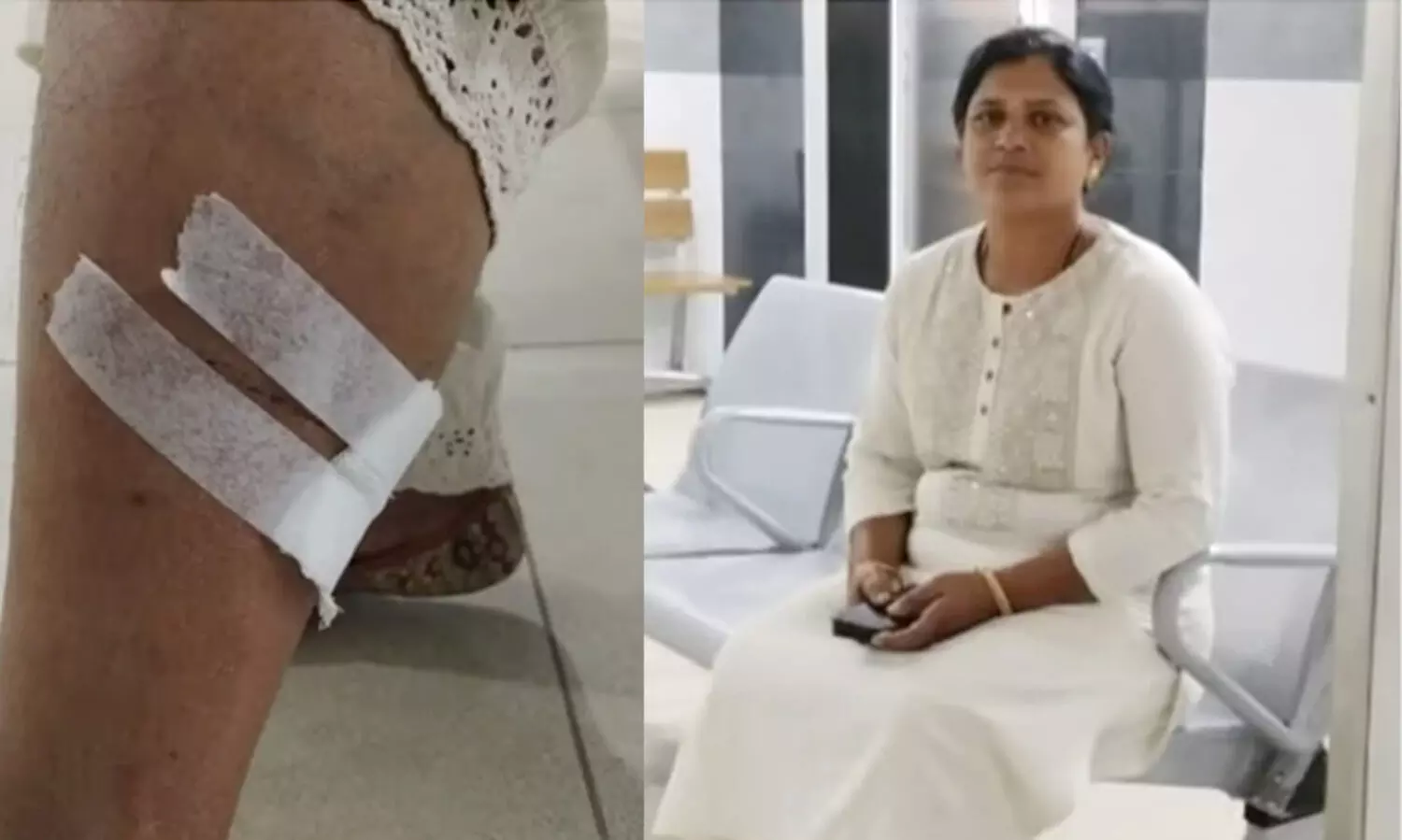 വോട്ട്​ ചോദിച്ചെത്തിയ യു.ഡി.എഫ് സ്ഥാനാർഥിയെ ഓടിച്ചിട്ട്​ കടിച്ച് നായ; ഓടി രക്ഷപ്പെട്ട് കൂടെയുള്ളവർ