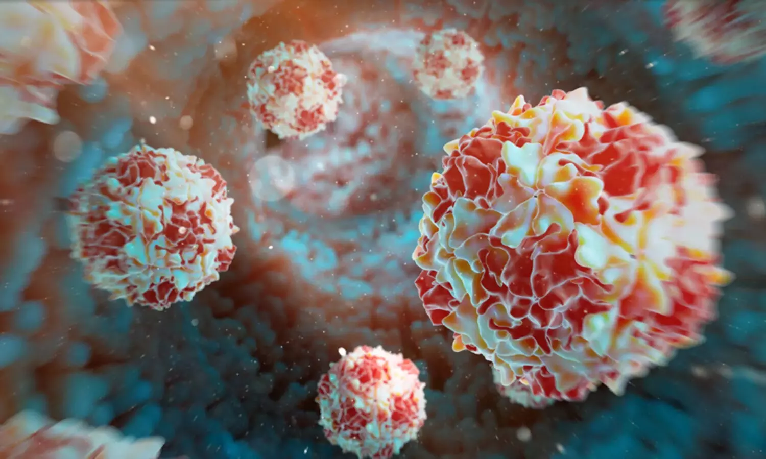 Detection of wild poliovirus type 1 in environmental sample in Germany