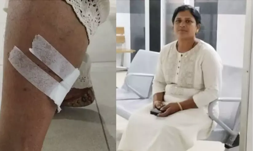 വോട്ട് ചോദിച്ചെത്തിയ യു.ഡി.എഫ് സ്ഥാനാർഥിയെ ഓടിച്ചിട്ട് കടിച്ച് നായ; ഓടി രക്ഷപ്പെട്ട് കൂടെയുള്ളവർ വോട്ട് ചോദിച്ചെത്തിയ യു.ഡി.എഫ് സ്ഥാനാർഥിയെ ഓടിച്ചിട്ട് കടിച്ച് നായ; ഓടി രക്ഷപ്പെട്ട് കൂടെയുള്ളവർ