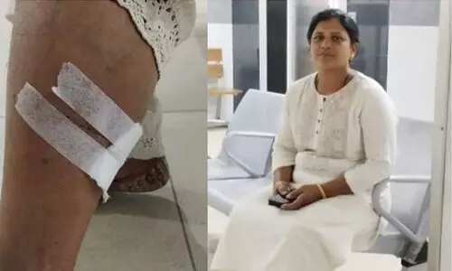 വോട്ട്​ ചോദിച്ചെത്തിയ യു.ഡി.എഫ് സ്ഥാനാർഥിയെ ഓടിച്ചിട്ട്​ കടിച്ച് നായ; ഓടി രക്ഷപ്പെട്ട് കൂടെയുള്ളവർ